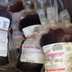 Image for article titled The Startup That'll Inject You With Young Blood Says It's Opening a Clinic In New York City